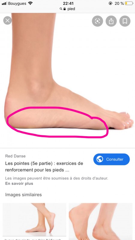 Douleur sur le côté du pied gauche, comment s'ap